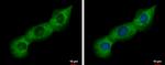 PABP Antibody in Immunocytochemistry (ICC/IF)