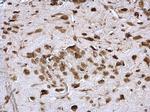 PABP Antibody in Immunohistochemistry (Paraffin) (IHC (P))