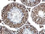 PABP Antibody in Immunohistochemistry (Paraffin) (IHC (P))