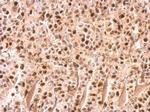 UHRF1 Antibody in Immunohistochemistry (Paraffin) (IHC (P))