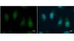 BMI-1 Antibody in Immunocytochemistry (ICC/IF)