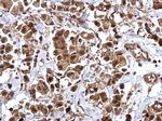 BMI-1 Antibody in Immunohistochemistry (Paraffin) (IHC (P))