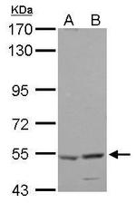 HARS Antibody in Western Blot (WB)