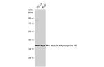 Alcohol Dehydrogenase 1B Antibody in Western Blot (WB)