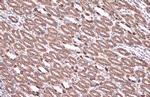 V-ATPase E1 Antibody in Immunohistochemistry (Paraffin) (IHC (P))