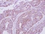 V-ATPase E1 Antibody in Immunohistochemistry (Paraffin) (IHC (P))