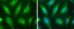 V-ATPase E1 Antibody in Immunocytochemistry (ICC/IF)