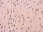 COMT Antibody in Immunohistochemistry (Paraffin) (IHC (P))