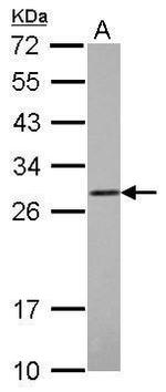 COMT Antibody in Western Blot (WB)