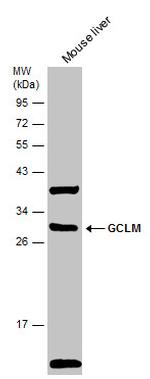 GCLM Antibody in Western Blot (WB)