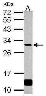 GCLM Antibody in Western Blot (WB)