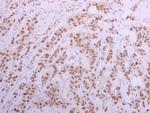 CUGBP1 Antibody in Immunohistochemistry (Paraffin) (IHC (P))