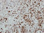 CUGBP1 Antibody in Immunohistochemistry (Paraffin) (IHC (P))