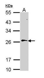 RAN Antibody in Western Blot (WB)