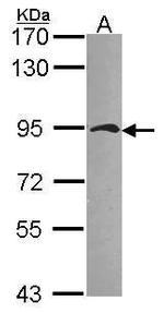 gamma Catenin Antibody in Western Blot (WB)