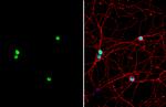 PUM2 Antibody in Immunocytochemistry (ICC/IF)