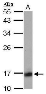 Calcineurin B Antibody in Western Blot (WB)