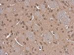 GSR Antibody in Immunohistochemistry (Paraffin) (IHC (P))