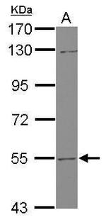 UGT2B7 Antibody in Western Blot (WB)