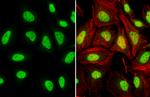 TDP-43 Antibody in Immunocytochemistry (ICC/IF)