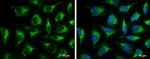 ACAA1 Antibody in Immunocytochemistry (ICC/IF)