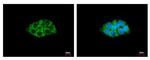 ACAA1 Antibody in Immunocytochemistry (ICC/IF)