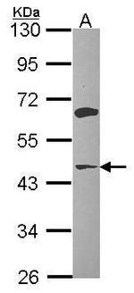 ACAA1 Antibody in Western Blot (WB)