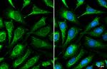 ACADVL Antibody in Immunocytochemistry (ICC/IF)