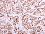 ACADVL Antibody in Immunohistochemistry (Paraffin) (IHC (P))