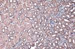 ACADVL Antibody in Immunohistochemistry (Paraffin) (IHC (P))