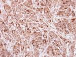 ACADVL Antibody in Immunohistochemistry (Paraffin) (IHC (P))