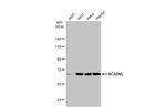 ACADVL Antibody in Western Blot (WB)