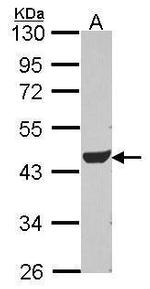 ADSL Antibody in Western Blot (WB)