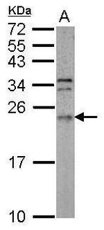 ARL3 Antibody in Western Blot (WB)