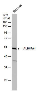 ALDH7A1 Antibody in Western Blot (WB)