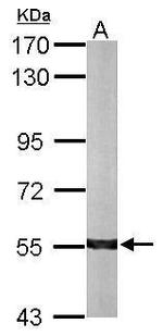 ALDH7A1 Antibody in Western Blot (WB)