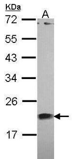 Centrin 1 Antibody in Western Blot (WB)