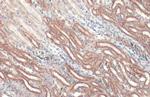 CPT1A Antibody in Immunohistochemistry (Paraffin) (IHC (P))