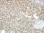 CtBP2 Antibody in Immunohistochemistry (Paraffin) (IHC (P))