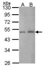 CtBP2 Antibody in Western Blot (WB)