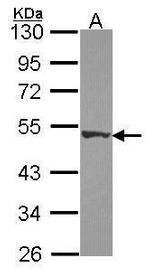 DPH2 Antibody in Western Blot (WB)