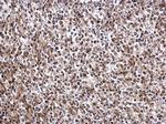 DRIL1 Antibody in Immunohistochemistry (Paraffin) (IHC (P))