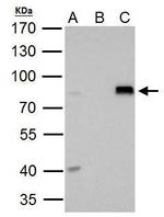 DRIL1 Antibody in Immunoprecipitation (IP)