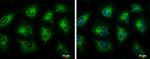 ECHS1 Antibody in Immunocytochemistry (ICC/IF)