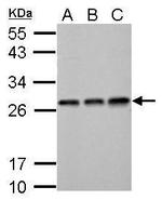 ECHS1 Antibody in Western Blot (WB)