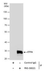 ETFA Antibody in Immunoprecipitation (IP)