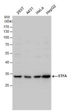 ETFA Antibody in Western Blot (WB)