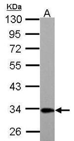 ETFA Antibody in Western Blot (WB)