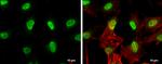 ETV5 Antibody in Immunocytochemistry (ICC/IF)