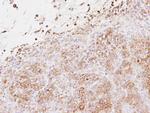 EXTL2 Antibody in Immunohistochemistry (Paraffin) (IHC (P))